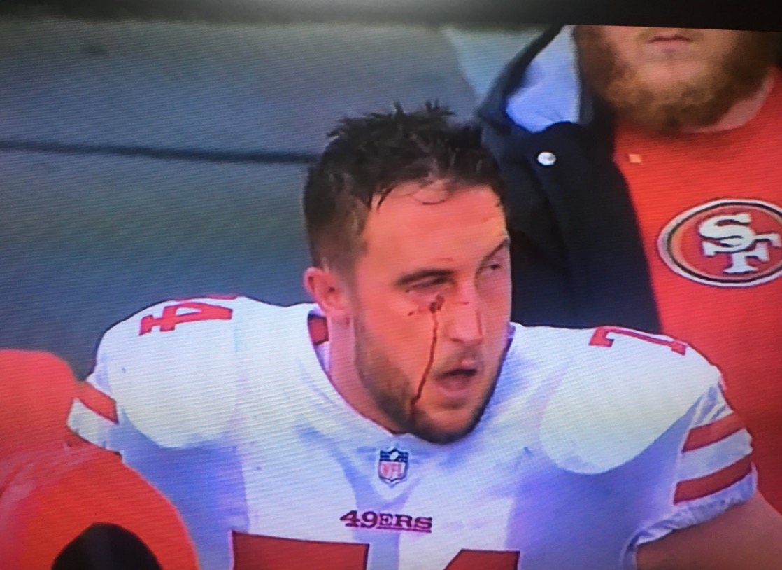 Report: NFL Reviewing Fletcher Cox “Cheap Shot” on Joe Staley