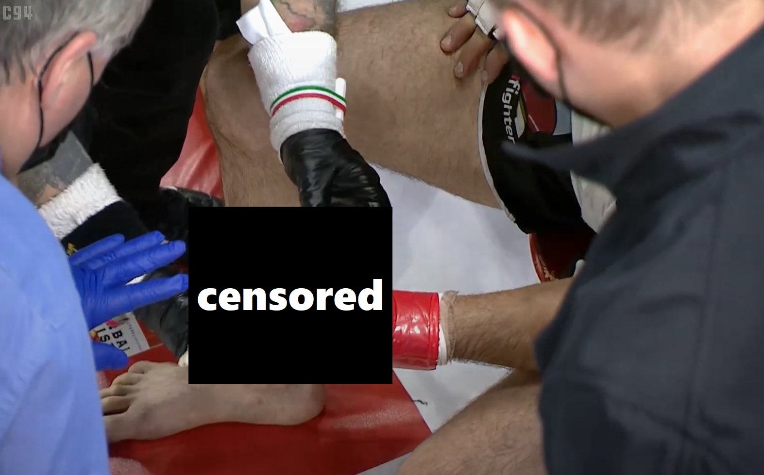 MMA Fighter Loses Finger at Philadelphia Event, Has it Re-Attached