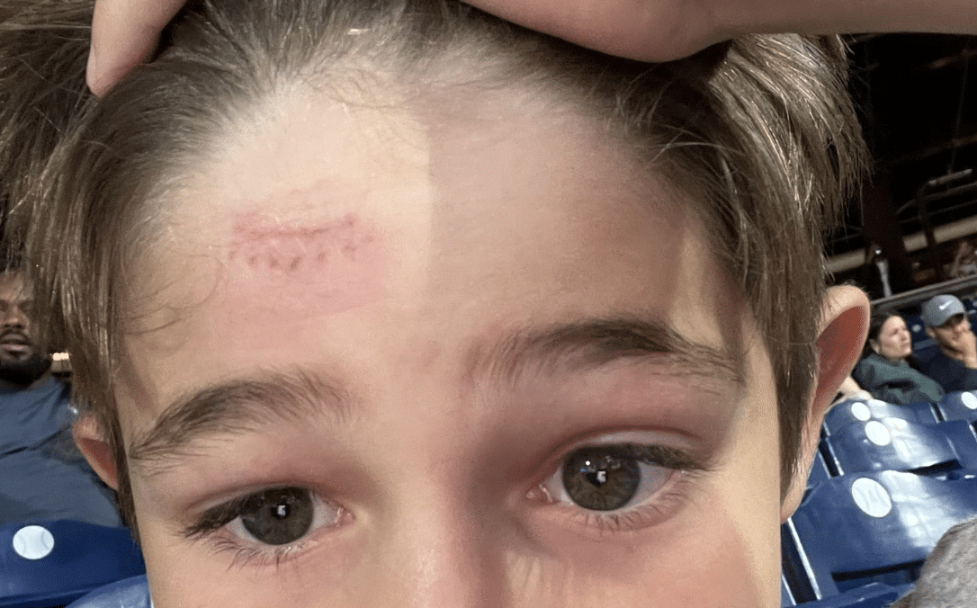 Nick Castellanos' Kid Took a Foul Ball to the Skull Like a Champ - Crossing  Broad